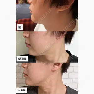 マイン美容外科口コミ