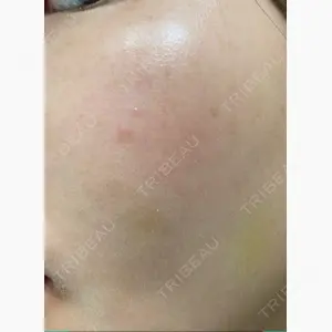 吉井クリニック口コミ
