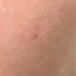 リッツ美容外科 大阪院口コミ