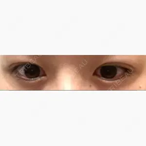 モティーフ銀座クリニック口コミ