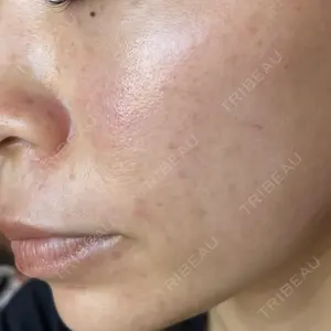 LIFIX BEAUTY CLINIC口コミ