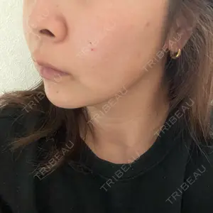 HAAB×DREAM BEAUTY CLINIC 東京本院口コミ
