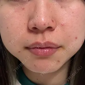 東京美専クリニック口コミ