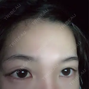 共立美容外科 新宿本院口コミ