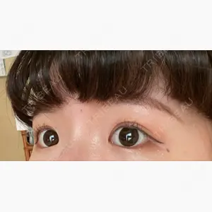 水の森美容クリニック 大阪梅田院口コミ