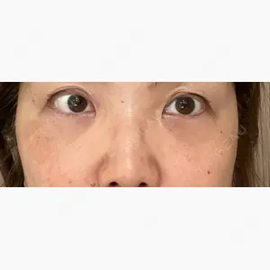 ヴェリテクリニック 銀座院口コミ