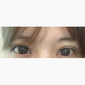 BELINDA CLINIC（ベリンダクリニック）新宿院口コミ