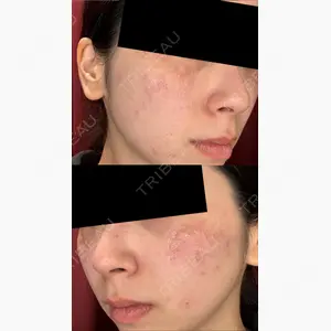 神楽坂美容クリニック タテバ芍薬口コミ