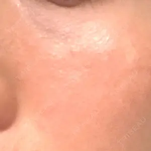 美容皮膚科エルムクリニック 広島院口コミ