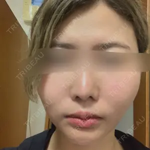 グローバルビューティークリニック 大阪院口コミ