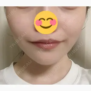 湘南美容クリニック 新橋銀座口院口コミ