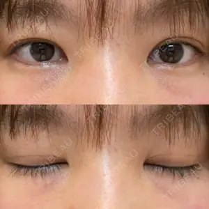 モティーフ銀座クリニック口コミ