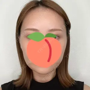 東京イセアクリニック口コミ