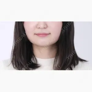 共立美容外科 梅田院口コミ