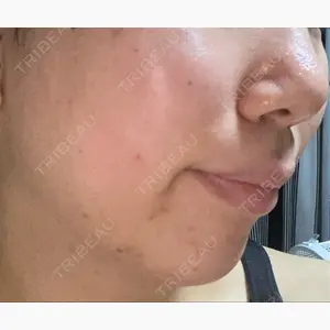 表参道美容外科クリニック口コミ