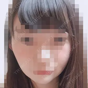 エートップ美容整形外科口コミ
