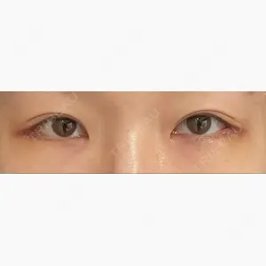 S.T styleクリニック口コミ