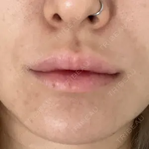 アスク美容クリニック銀座口コミ