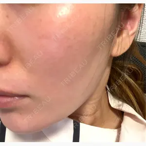 美容皮膚科エルムクリニック 岡山院口コミ