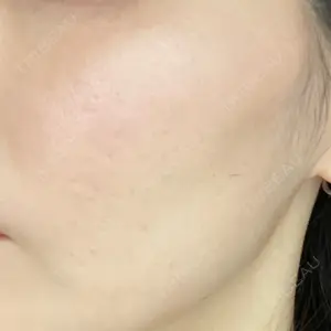 東京美容外科 京都河原町院口コミ