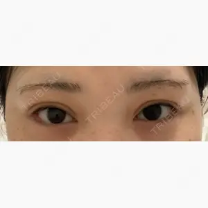 HAAB×DREAM BEAUTY CLINIC 東京本院口コミ