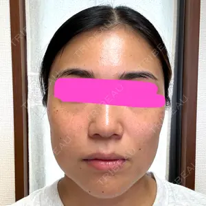 東京美容外科 京都河原町院口コミ