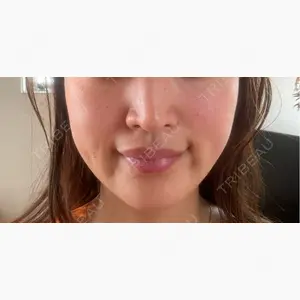 VSラインクリニック-江南店口コミ