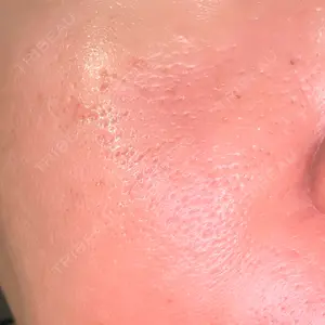 B-LINE CLINIC 大阪院口コミ