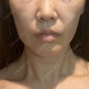 X CLINIC 恵比寿院口コミ
