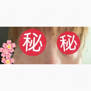 東京形成美容外科 船橋院口コミ