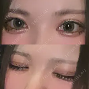 BELINDA CLINIC（ベリンダクリニック）新宿院口コミ