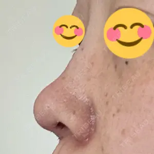 R Beauty CLINIC 銀座院口コミ