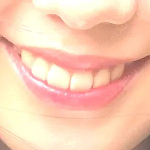 銀座青山You矯正歯科 渋谷院口コミ