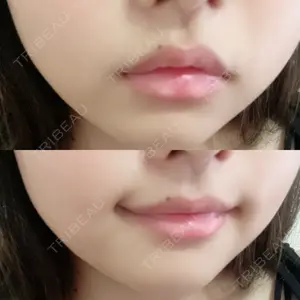 あいちビューティークリニック口コミ