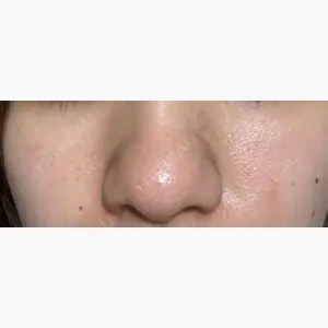 エストクリニック 横浜院口コミ