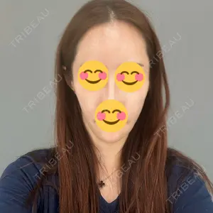 東京美専クリニック口コミ