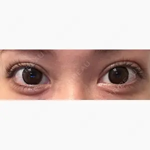 BELINDA CLINIC（ベリンダクリニック）新宿院口コミ