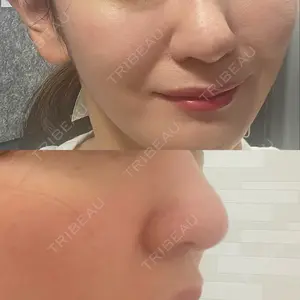 東京美専クリニック口コミ