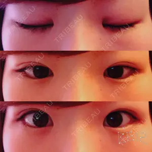 共立美容外科 高松院口コミ