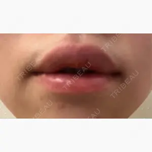 くさのたろうクリニック口コミ