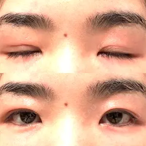 水の森美容クリニック 大阪梅田院口コミ