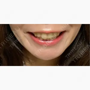 とよまき矯正歯科口コミ