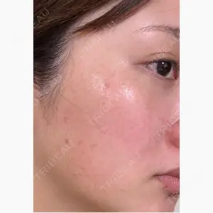 東京美容クリニック 表参道本院口コミ