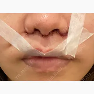 ゆきスキンクリニック 東池袋口コミ