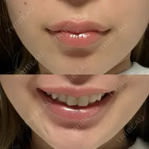 BELINDA CLINIC（ベリンダクリニック）岡山院口コミ
