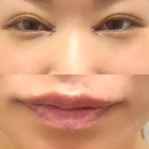 TCB東京中央美容外科 なんば院口コミ