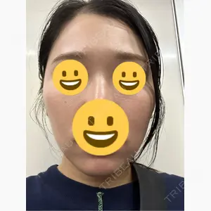 LUNA BEAUTY CLINIC GINZA口コミ