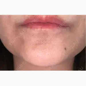 BIANCA表参道口コミ