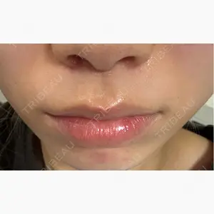もとび美容外科クリニック 新宿院口コミ