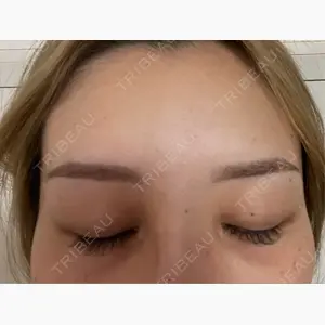 APスキンクリニック銀座口コミ